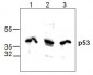 p53 Antibody
